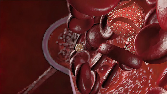 身体内胆固醇导致血管隔绝循环实验室红细胞黄疸微生物学死亡贫血生物血浆细胞质背景图片