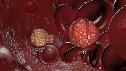 聚能蜂窝内胆身体内胆固醇导致血管隔绝贫血黄疸生物学化学癌症感染细胞学技术红细胞细胞质背景