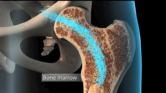 破骨细胞瘤成骨细胞人体组织高清图片