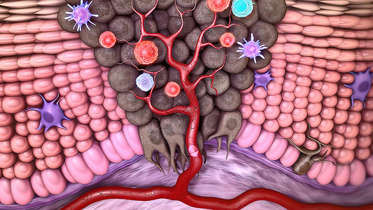 T细胞清扫肿瘤细胞医疗结构免疫学免疫倍率人类计算机作用胰腺单细胞图片