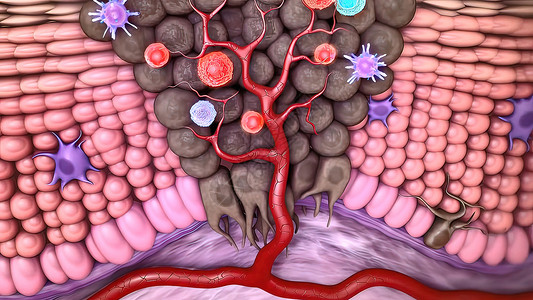 T细胞清扫肿瘤细胞生物微生物机制免疫医学图像绘图人类文件免疫系统背景图片