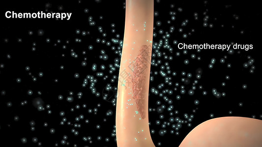 3d纹身素材化疗应用在肿瘤地区 肿瘤被清理干净了生物学身体医学诊断细胞病人药品保健微生物学生物背景