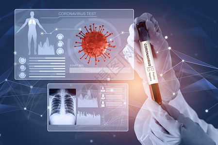 药检Corona病毒 COVID19医学测试疫苗研发概念过程医院样本肺炎药品研究学习科学技术实验疫情背景
