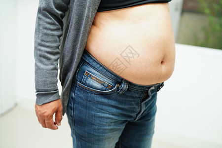 亚裔女性在办公室显示胖肚子大超重和肥胖症腰部展示工作塑料手术治疗肌肉损失锻炼女士背景图片