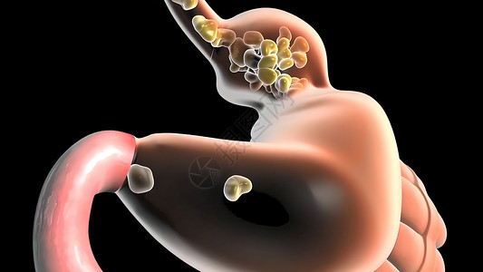 食物通过消化道流经原理图肠道尿道体积宽慰技术作品背景膀胱飞机背景图片