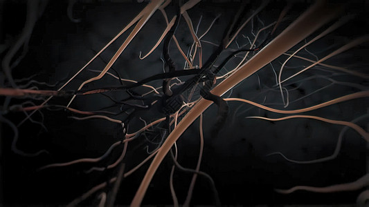 神经图3D医疗3D神经元死亡损失细胞老化身体生活进步治疗疾病思维困惑背景