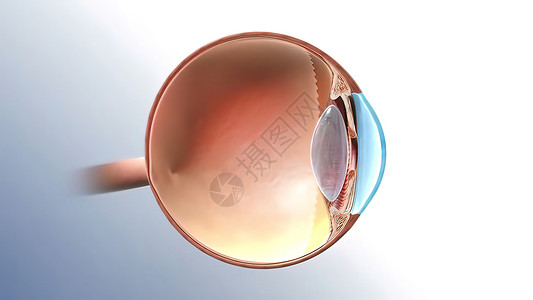 汗腺Glaucoma眼病 3D例感染保健皮肤药品医生疼痛宏观细菌皮肤科脓肿背景