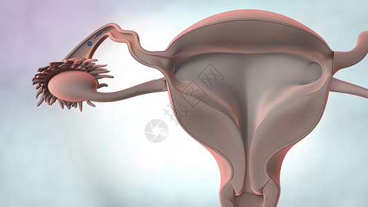 3D说明 女性生殖器官解剖运动医疗器官月经女士娱乐遗传生殖器输卵管经期图片