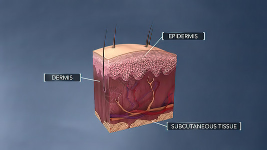 皮肤解解剖结构卵泡伤害事故头发表皮癌症图层插图艺术解剖学图片