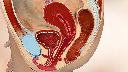 子宫内膜增生3D 医学插图 女性生殖系统 月经周期医疗癌症怀孕妇科子宫激素身体药品纤维生育力背景
