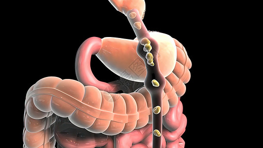 食物通过消化道流经膀胱肠道系统体积阴影宽慰大肠作品尿道背景背景图片
