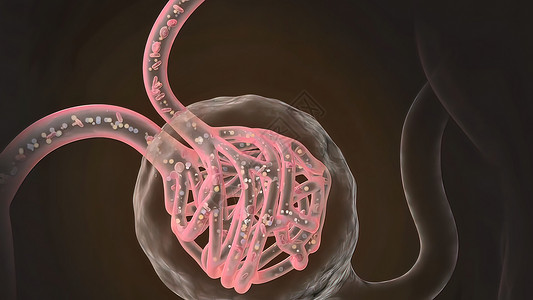 输尿管结石Renal系统 Renal血液循环疾病输尿管科学尿液白色生理信息微生物学学习肾病背景