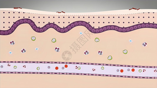 过敏性皮肤细菌 创伤 毒素 热或其他任何原因导致的炎症 组织损伤皮肤抗体图表疼痛过敏性抗原桅杆淋巴药品免疫学背景