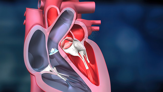 冠状动脉粥样硬化性心脏病心脏工作系统 通过人体血液抽血渲染心脏病骨骼生物学动脉粥样硬化疼痛解剖学计算机主动脉心血管背景