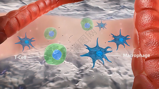 巨噬细胞T细胞大型巨形相互作用和血管炎中形成颗粒瘤微生物学免疫感染生物攻击抗体渲染显微镜细菌身体背景