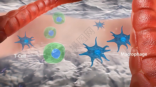 T细胞大型巨形相互作用和血管炎中形成颗粒瘤药品细胞因子免疫系统渲染细菌毒性癌症感染单细胞免疫背景