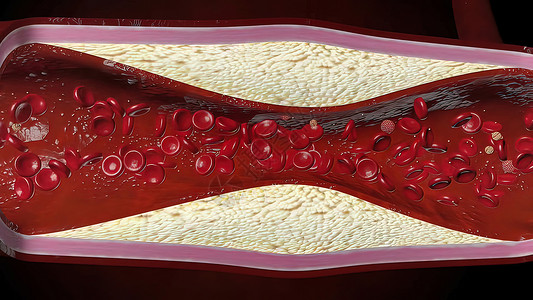 高密度脂蛋白HDL胆固醇药品血清心血管公式化学品原子纽带作品动脉粥样硬化甾醇背景图片