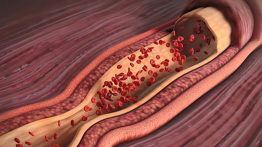 肌肉结构尼古丁会提高血压插图心室心电图动脉流动心血管生物学身体攻击阀门背景