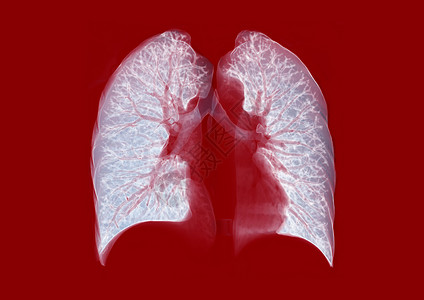 CT Chest 或 Lung 3D 以红色背景为图象进行诊断图片