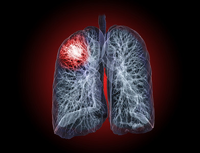 肺病学医生扫描高清图片