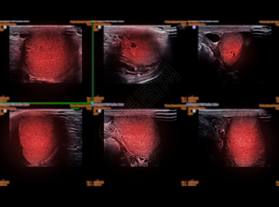 光谱学分析超声检查高清图片