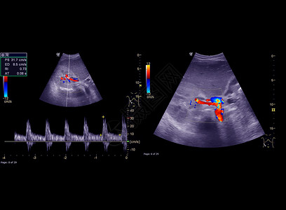 多普勒超声健康药品高清图片