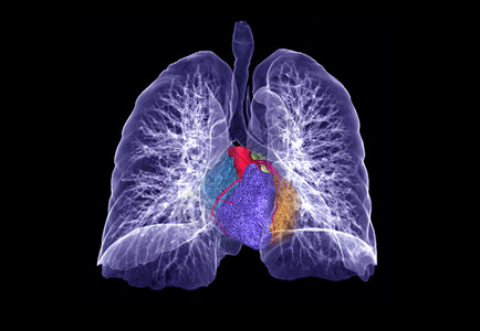 肺科医师CT 肺3d 肝脏成象电脑结节屏幕心血管电影隔膜插图肋骨心脏病学医生背景