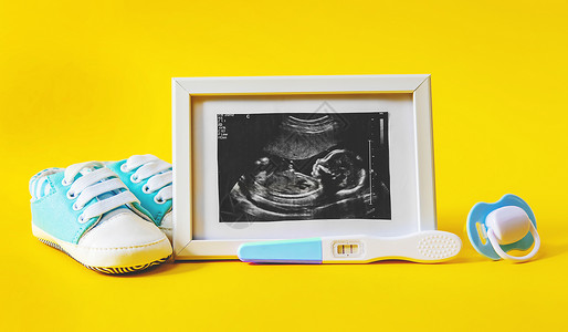 婴儿的照片和配件的超音速照片 有选择的聚焦点胎儿超声子宫超声波男生考试技术母性新生女士背景图片