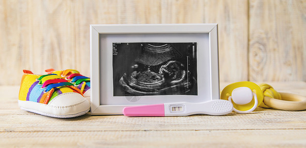 环图婴儿的照片和配件的超音速照片 有选择的聚焦点生活扫描超声波子宫横幅孩子母性女士检查药品背景