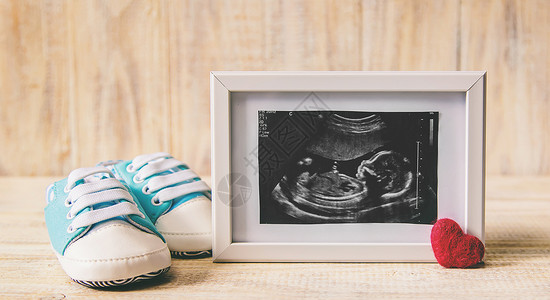 婴儿的照片和配件的超音速照片 有选择的聚焦点检查女士母亲超声波母性男生药品腹部孩子胎儿背景图片