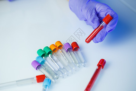 红色手套医学专家 实验室助理 医生在实验室进行分析 使用试管 吸管和培养皿来检测人体中细菌的存在 选择性焦点女性技术科学家成人手套团体实背景