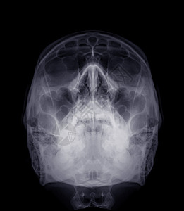 人类水景的X光图像背景图片