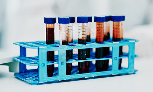 搜索血的素材特写血液 试管或科学实验室的医学研究 用于测试 检查或检查 DNA 样本 寻找马尔堡病毒 猴痘或全球大流行病的突破性治疗方法背景