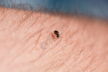 血与小的素材一只小黑昆虫坐在手的近切处 在你的手掌中 有昆虫漏洞学家翅膀季节荒野皮肤野生动物生物学瓢虫害虫背景