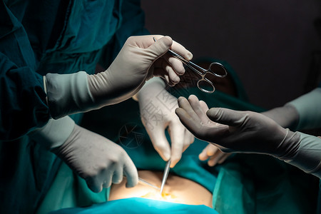 递剪刀手术队的外科手术图象显示 护士会伸出消毒剪刀房间麻醉医院团队蓝色男人操作病人手套服务背景