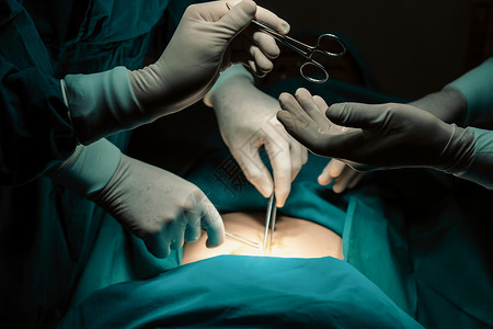 递剪刀手术队的外科手术图象显示 护士会伸出消毒剪刀药品情况团队医生工作医院手套药物治疗男人专家背景