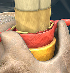 椎间孔镜滑动盘也可以称为折叠或嵌入盘片骨干脊椎模型光盘脊柱外科神经整形腰椎椎骨背景