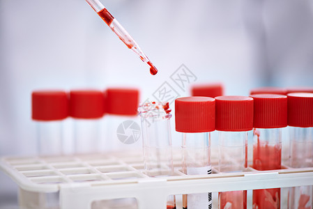 血液测试是时候分析你的血液了 一名科学家在实验室里用血样做实验背景