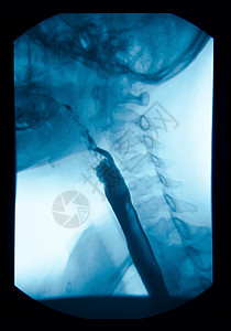 X射线高肠胃肠 UGI Esophagram 医师 食管背景图片