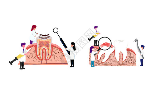 牙龈病变分段的牙龈高清图片