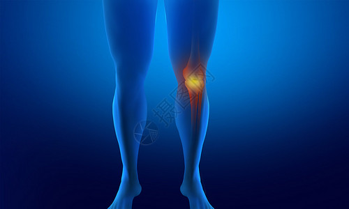 腿关节受伤骨折腿设计图片