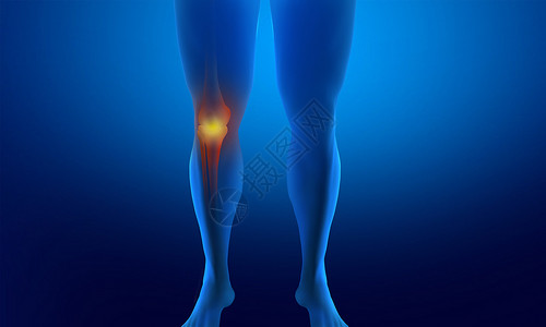 腰腿酸痛受伤骨折腿设计图片