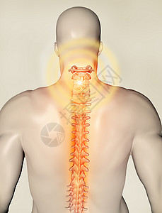 背部颈椎骨折高清图片