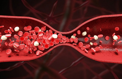血管狭窄全能干细胞高清图片