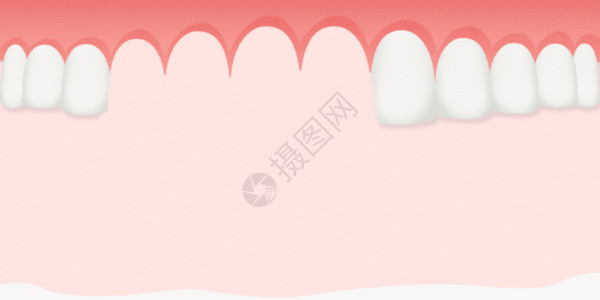 牙医背景种植牙齿GIF高清图片