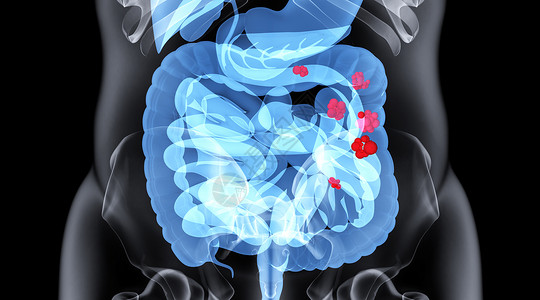 调理肠道肠道疾病场景设计图片