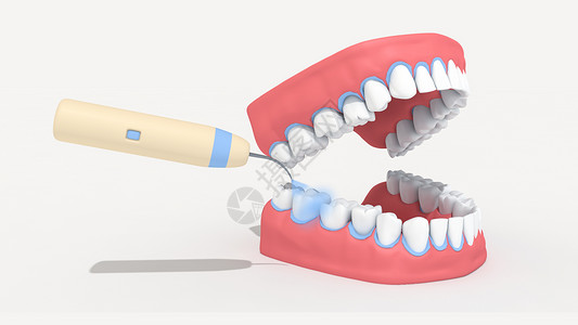 洗牙立体牙齿模型高清图片