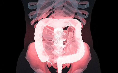 大肠包小肠人体肠道疾病设计图片
