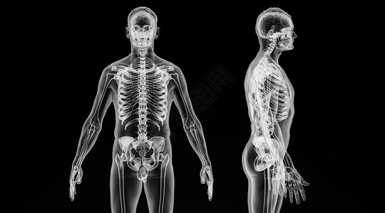 人体四肢X光人体骨骼场景设计图片