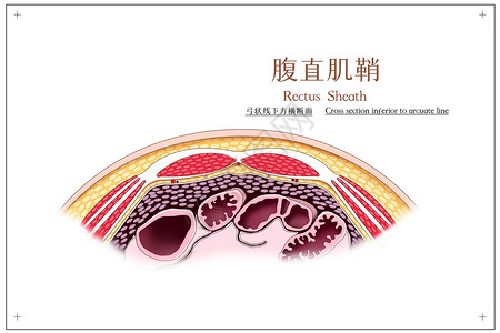 腹直肌鞘弓状线下方横断面医疗插画高清图片